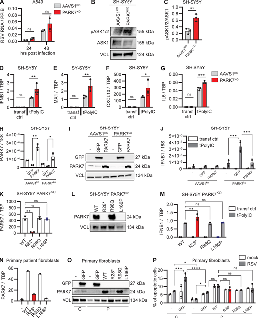 Enhanced cellular stress pathways and hyperinflammatory cytokine responses in PARK7-deficient neuronal SH-SY5Y cells. (A) Human pulmonary A594 cells deficient in PARK7 (red) and control AAVS1KO (grey) were mock treated or infected with RSV (RSV-A strain Long, MOI 1) for 24 and 48 h, and cells were collected for RNA isolation and analysis of RSV RNA by RT-PCR. Bars indicate mean ± SD values of two experiments, performed in duplicate. Repeats of the experiments are shown in Fig. S3 E. (B and C) Whole cell lysates from SH-SY5Y with PARK7KO (red) or AAVS1KO (control, grey) were analyzed for phosphorylation of ASK1/2 (pASK1/2) and expression of total ASK1 and vinculin (VCL) as loading control by immunoblotting (B). Graph depicting the densitometric quantification of pASK1/2 relative to total ASK1 (C). Bars indicate the mean ± SD values of three experiments. (D–G) Neuronal SH-SY5Y cells deficient in PARK7 or control AAVS1KO were mock transfected (transf ctrl) or transfected with PolyIC (tPolyIC, 500 ng/ml). Cells were collected after 6 h, and RNA was isolated, and IFNB1 (D), MX1 (E), CXCL10 (F), and IL6 (G) gene transcription quantification by RT-PCR. Bars indicate mean ± SD values of a representative experiment performed in triplicate. Repeats of the experiment are shown in Fig. S3, N–Q and R–U. (H–J) Neuronal SH-SY5Y cells deficient in PARK7 or AAVSKO (control) were left untransduced (−) or were transduced with lentiviral vectors to express PARK7 or GFP (control). Cells were collected after 48 h for RNA isolation to determine PARK7 mRNA expression (H), and whole cell lysates were analyzed by immunoblotting for GFP and PARK7 expression with VCL as loading control (I). (J) Cells were transfected with PolyIC (tPolyIC, 500 ng/ml) and collected after 6 h for quantification of IFNB1 transcription by RT-PCR. Bars indicate mean ± SD values of a representative experiment performed in duplicate. (K–M) Neuronal SH-SY5Y cells deficient for PARK7 were transduced with lentiviral vectors to express PARK7 WT, the patient PARK7 variant R28*, the R98Q variant frequent in the healthy population (MAF>10−3), and the L166P variant associated with Parkinson’s disease. Cells were collected for RNA isolation to determine PARK7 mRNA expression (K), and whole cell lysates were analyzed by immunoblotting for PARK7 expression with VCL as loading control (L). (M) Cells were transfected with PolyIC (tPolyIC, 500 ng/ml) and collected after 6 h for quantification of IFNB1 transcription by RT-PCR. Bars indicate mean ± SD values of a representative experiment performed in duplicate. (N–P) Primary fibroblasts from the patient (P) were left untransduced (−) or were transduced with lentiviral vectors to express GFP, PARK7WT, PARK7 R28*, PARK7 R98Q, or PARK7 L166P. As control (C), primary fibroblasts from a healthy donor were left untransduced or were transduced to express GFP. Cells were collected for RNA isolation to determine PARK7 mRNA expression (N), and whole cell lysates were analyzed by immunoblotting for GFP and PARK7 expression with VCL as loading control (O). Cells were infected with mock virus (mock) or RSV (RSV-A strain Long, MOI 3, 24 h) and stained with Annexin-V (apoptosis) and 7-AAD (viability dye) to analyze induction of noninflammatory apoptotic cell death by flow cytometry (P). Bars show mean ± SD values of a single experiment performed in duplicate and triplicate. Statistics were calculated using the multiple paired t test (A), the unpaired t test (C), the one-way ANOVA (H and K), and ordinary two-way ANOVA with Šídák’s multiple comparisons (J, M, and P). * = P < 0.05, ** = P < 0.01, *** = P < 0.001, and ns = not significant. SD, standard deviation. Source data are available for this figure: SourceData F4. Refer to the image caption for details.