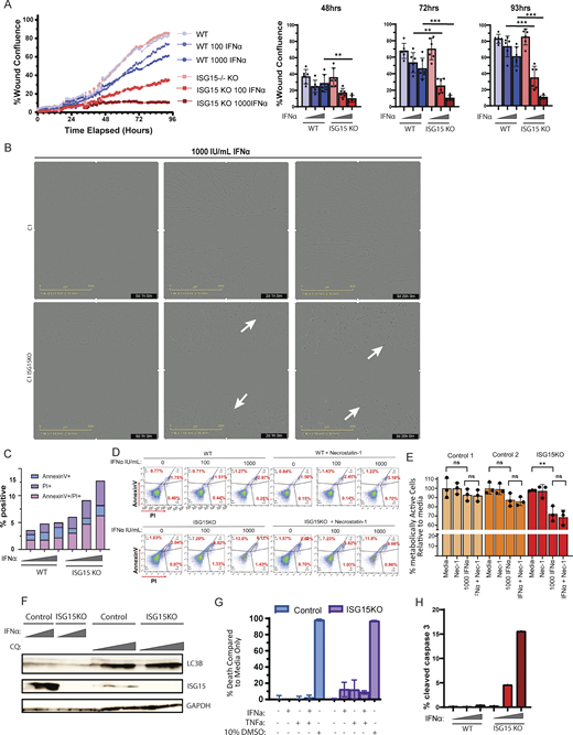 IFNα induces apoptosis in ISG15 KO cells. (A) Healing/migration ability of WT and ISG15 KO fibroblasts was assessed with the scratch assay. Left; percent confluency was recorded every hour for a total of 93 h. Right; experimental replicates at 48, 72, and 93 h after scratch. (B) Representative images of WT and ISG15 KO fibroblasts at 1 h (left), 49 h (middle), and 92 h (right) of 1,000 IU ml−1 IFNα treatment. White arrows indicate macroscopic evidence of cellular stress. (C) WT and ISG15 KO fibroblasts were treated with IFNα2b (0, 100, 1,000 IU/ml) for 72 h, and cell death was quantified by measuring Annexin V and Propidium Iodide (PI) levels through flow cytometry. (D) Control and ISG15 KO fibroblasts were treated with IFNα2b (0, 100, 1,000 IU/ml) for 72 h following a 30-min pretreatment with necrostatin-1, and cell death was quantified by measuring Annexin V and PI levels through flow cytometry. (E) Metabolic activity of two control and one ISG15 KO fibroblast cell lines was assessed with the Deep Blue assay. Nec-1; necrostatin-1. (F) Control and ISG15-deficient fibroblasts were treated with either IFNα2b (1, 100, 1,000 IU/ml) or chloroquine (0, 25, 50, 100 μM) for 72 h. Cell lysates were analyzed by western blotting for autophagy (LC3B). (G) Control and ISG15-deficient fibroblasts were treated with either IFNα2b (100 IU/ml), or TNFα (5 ng/μl), or both for 72 h, and percent death was assessed with the Deep Blue assay as compared to the nontreated condition for each variant. (H) WT and ISG15 KO fibroblasts were treated with IFNα2b (0, 100, 1,000 IU/ml) for 72 h, and cell death was quantified by measuring cleaved (active) caspase 3 levels through flow cytometry. Source data are available for this figure: SourceData F7. P values were calculated with two-tailed t test. **P < 0.01; ***P < 0.001.