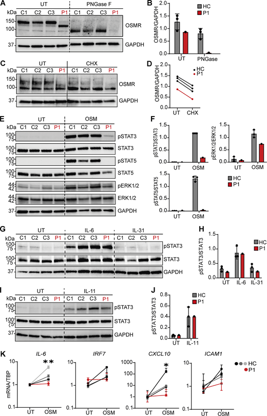 Patient fibroblasts show different OSMR glycosylation and impaired signaling downstream of OSM. (A) Endogenous OSMR expression in fibroblast lysates from P1 and three healthy controls (HCs) with or without PNGase treatment. (B) Quantification of OSMR band intensities relative to GAPDH from A. (C and D) OSMR production of dermal fibroblasts from P1 and HCs treated with 25 µg/ml protein synthesis inhibitor (cycloheximide, CHX; 1M) for 24 h, and (D) quantification of WT OSMR bands and variant OSMR band intensities relative to GAPDH from C. Experiments shown in A and C were repeated twice with dermal fibroblasts from the patient and three HCs each. (E and F) Dermal fibroblasts from P1 and three HCs were stimulated with OSM (5 ng/ml) for 30 min. Whole-cell lysates were harvested for WB for the visualization of pSTAT3, STAT3, pSTAT5, STAT5, pERK1/2, ERK1/2, and GAPDH and quantification of WB band intensities shown in F. (G–J) Serum-starved dermal fibroblasts from P1 and three HCs were stimulated with IL-6 (100 ng/ml), IL-31 (100 ng/ml), or IL-11 (100 ng/ml) for 30 min. Whole-cell lysates were harvested for WB (G and I) for the visualization of pSTAT3, STAT3, and GAPDH and band intensities quantitated (H and J). (K) Dermal fibroblasts from P1 and HCs were stimulated with OSM (10 ng/ml) for 2 or 6 h. Total RNA was harvested for expression analysis by RT-PCR after 2 h for IL-6 and after 6 h for IRF7, CXCL10, and ICAM1. Data are representative of three independent experiments performed in quadruplicates. Statistics were calculated using the unpaired t test and comparing pooled samples from controls to patient. UT, untreated. * = P < 0.05, ** = P < 0.01. Source data are available for this figure: SourceData F3.