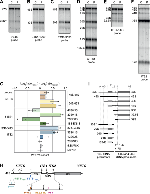 A multi-part image depicts pre-rRNA processing affected by WDR75 variants.