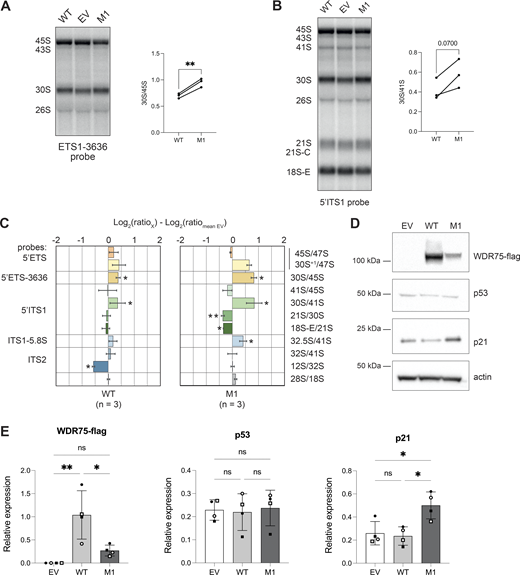 Multiple graphs and blots depict the effects of WDR75 inactivation and ectopic expression of WDR75 p.T46I on pre-rRNA processing and protein expression in U2OS cells.