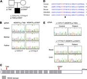 A multi-panel image illustrating the genetic analysis of a patient with WDR75 gene variants.