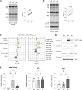 Multiple graphs and blots depict the effects of WDR75 inactivation and ectopic expression of WDR75 p.T46I on pre-rRNA processing and protein expression in U2OS cells.
