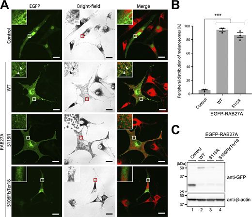 A multi-panel image showing the subcellular localization of melanosomes in RAB27A-deficient melanocytes expressing different RAB27A variants.
