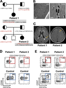 A multi-panel image showing genetic, microscopic, MRI, and flow cytometry data related to two patients with Griscelli syndrome type 2.