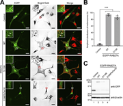 A multi-panel image showing the subcellular localization of melanosomes in RAB27A-deficient melanocytes expressing different RAB27A variants.