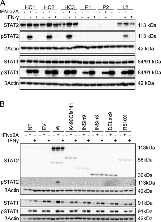 A two-panel image showing immunoblot analysis of STAT2 protein expression and phosphorylation in primary fibroblasts and transfected HEK293T cells.