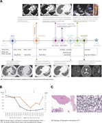 A multi-panel image of a patient's medical history from birth to death, highlighting key events, treatments, and imaging results.