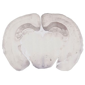 Special Collection Image